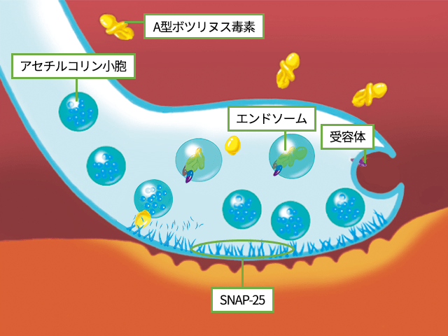 ボトックス