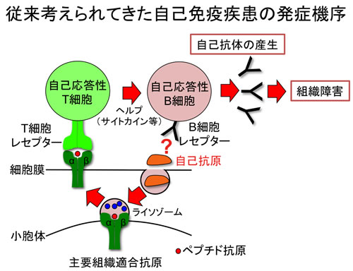 自己免疫疾患の発症機序