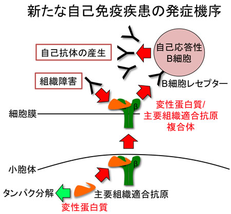 自己免疫疾患の発症機序